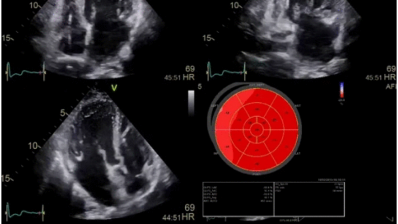 4D απεικόνιση στο Εργαστήριο Ηχωκαρδιογραφίας του Mediterraneo Hospital 4D απεικόνιση στο Εργαστήριο Ηχωκαρδιογραφίας του Mediterraneo Hospital