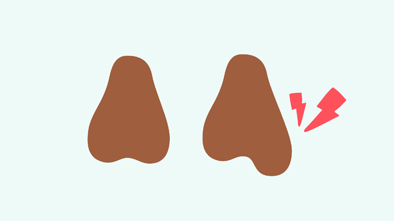 Ποιες είναι οι πιο συνηθισμένες αιτίες του πόνου στους όρχεις;