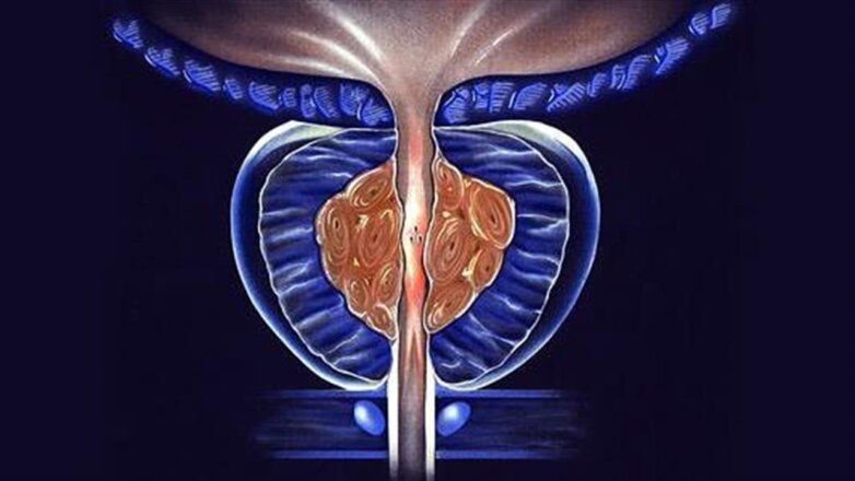 Ενημερωτική εκστρατεία της ΕΛΛΟΚ για τον καρκίνο του προστάτη – «Ο πιο σπουδαίος αγώνας είναι ο δικός σου!» Ενημερωτική εκστρατεία της ΕΛΛΟΚ για τον καρκίνο του προστάτη – «Ο πιο σπουδαίος αγώνας είναι ο δικός σου!»