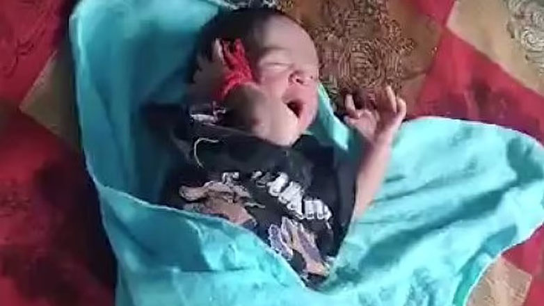 Ινδία: Μωρό γεννήθηκε με 14 δάχτυλα στα χέρια και 12 δάχτυλα στα πόδια