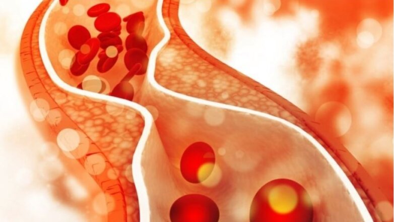 Πώς τα αιμοφόρα αγγεία σας ανέχονται την υψηλή αρτηριακή πίεση