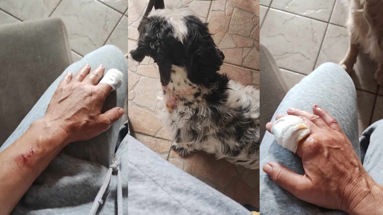 Γυναίκα δέχθηκε επίθεση από πιτ μπουλ στην Ηγουμενίτσα