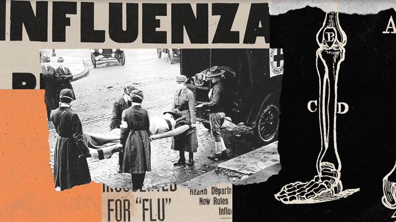 Η ιστορία λέει ότι η γρίπη του 1918 σκότωσε νέους και υγιείς, αλλά νέα μελέτη οστών το διαψεύδει