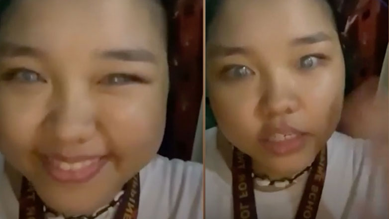 Γυναίκα με ασημένιο βλέμμα από σπάνια ασθένεια