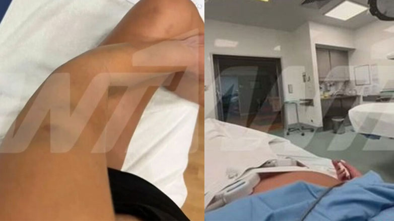 Γνωστός επιχειρηματίας κατηγορείται ότι ξυλοκόπησε την 27χρονη σύντροφό του στον 9ο μήνα της εγκυμοσύνης της