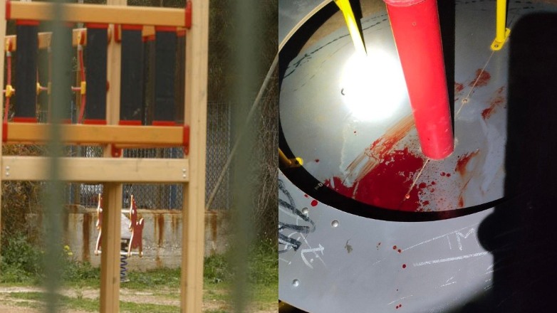 Εκτός κινδύνου η 14χρονη που τραυματίστηκε σε παιδική χαρά στην Αλεξανδρούπολη