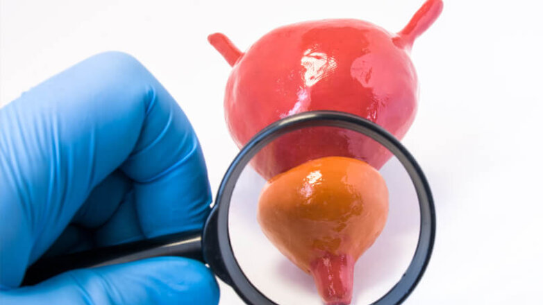 Καρκίνος Προστάτη: Fusion βιοψία και ρομποτική προστατεκτομή