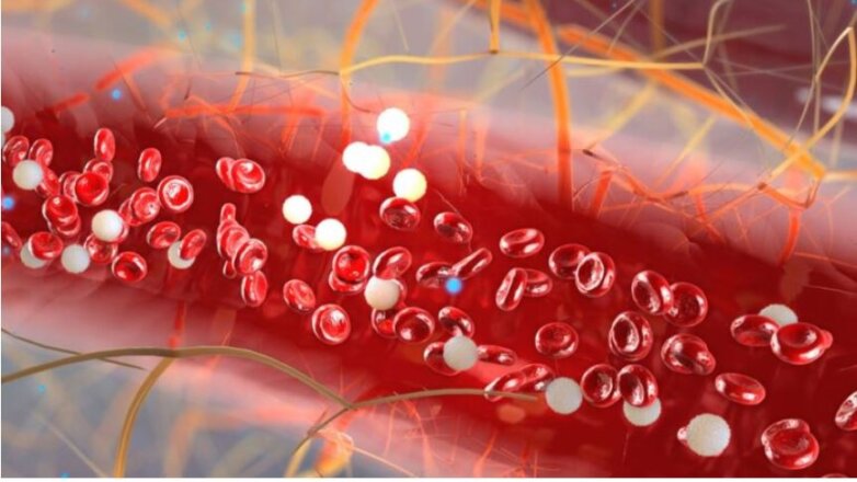 Προκλήσεις στην αντιμετώπιση των ασθενών με Μυελοδυσπλαστικά Σύνδρομα