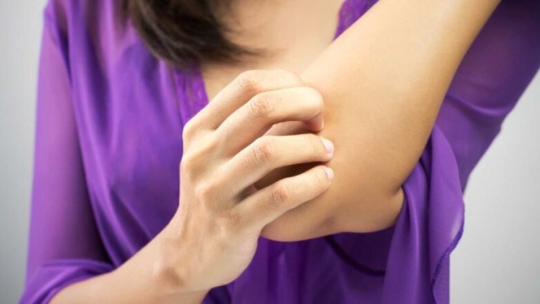 Εξάρσεις εκζέματος: Πότε φταίνε οι ορμόνες;