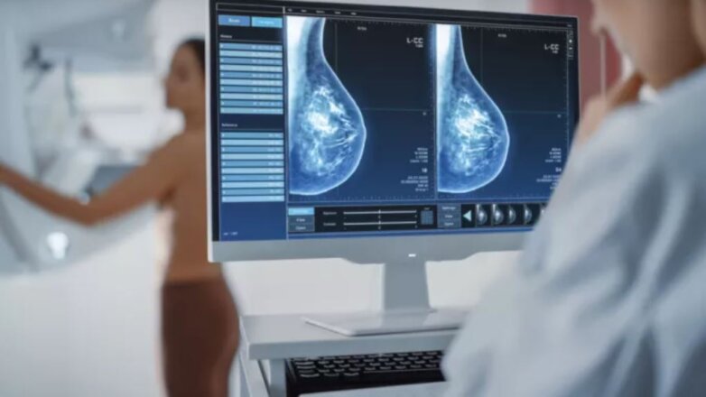 Τεχνητή Νοημοσύνη στη μαγνητική τομογραφία μαστού Horizon 2022 – Ερευνητικό πρόγραμμα Odelia Τεχνητή Νοημοσύνη στη μαγνητική τομογραφία μαστού Horizon 2022 – Ερευνητικό πρόγραμμα Odelia