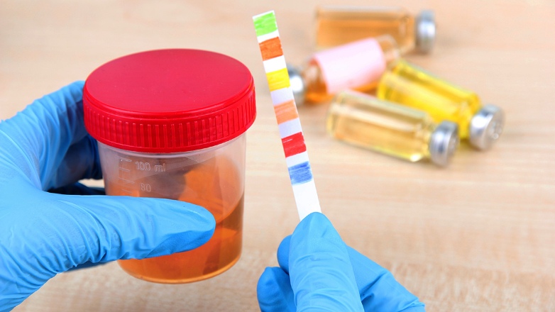 Ουρολοιμώξεις συνδέονται με κατανάλωση μολυσμένου κρέατος