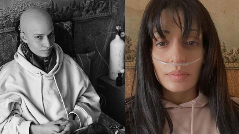 Τόνια Σωτηροπούλου: Βήμα-βήμα η συγκλονιστική μεταμόρφωσή της στην καρκινοπαθή ηρωίδα του «Milky Way»