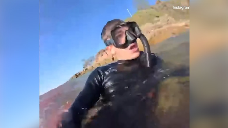 Βίντεο-σοκ μετά από επίθεση καρχαρία σε 20χρονο στην Αυστραλία – «Δεν πίστευα ότι θα ζήσω»