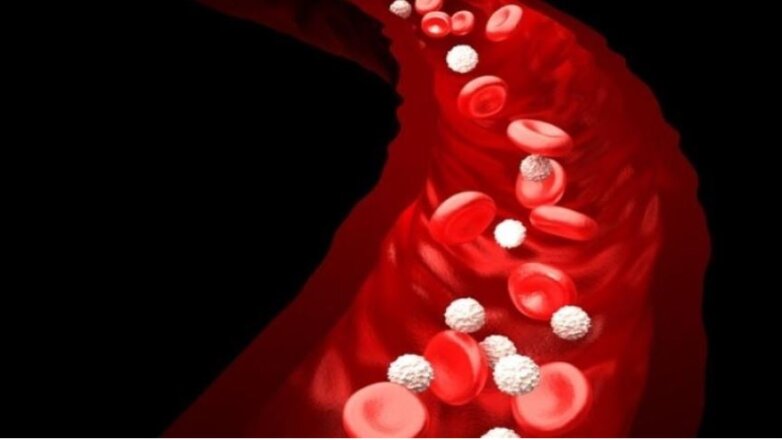 Παγκόσμια Ημέρα Θρόμβωσης: Μια σιωπηλή απειλή που μπορούμε να προλάβουμε