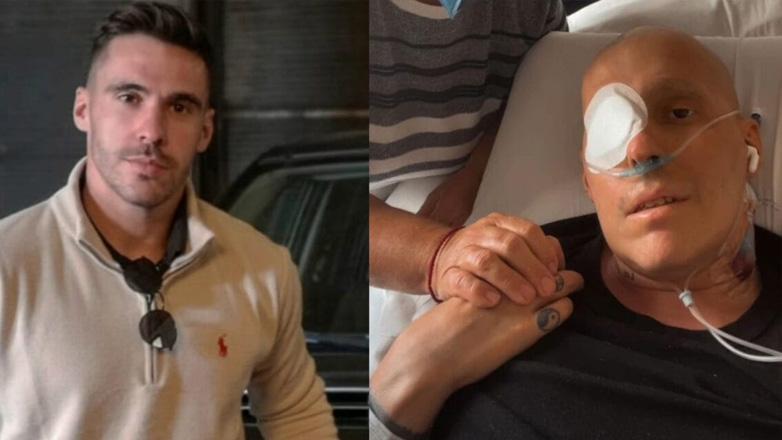 Τι είναι το λέμφωμα Μπέρκετ που «σκότωσε» τον Γιώργο Ζαγκλιβέρη