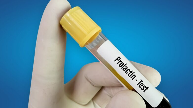 Δύο μελέτες συνδέουν μια βασική ορμόνη με τον καρκίνο του μαστού