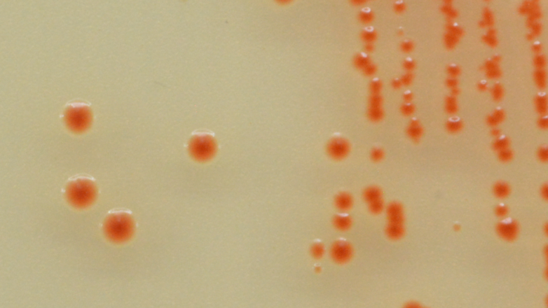 Γιατί υπάρχει άνοδος των περιστατικών στρεπτόκοκκου στα παιδιά;