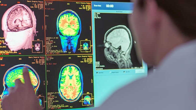 13χρονο παιδί θεραπεύτηκε από καρκίνο του εγκεφάλου