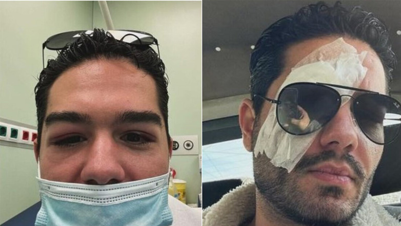 Χρήστος Μάστορας: Οι φωτογραφίες που ανέβασε και το μακροσκελές μήνυμα για το σοβαρό πρόβλημα υγείας του