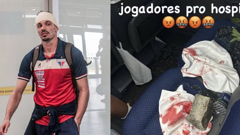 Eικόνες-σοκ: Έξι παίκτες της Φορταλέζα τραυματίστηκαν μετά από επίθεση οπαδών στο λεωφορείο της ομάδας!