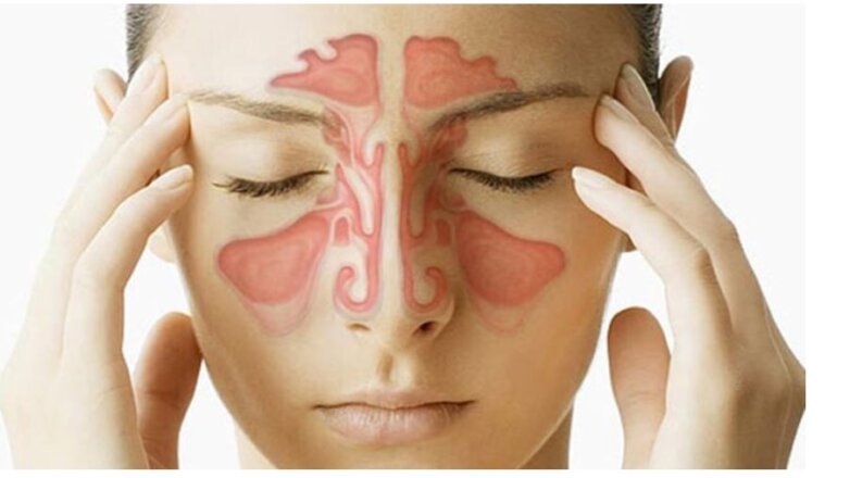 Ιγμορίτιδα: τι την προκαλεί & πως την αντιμετωπίζουμε