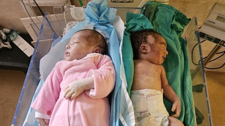 Γάζα: Βρέφη πεθαίνουν από υποσιτισμό και αφυδάτωση μέσα σε νοσοκομείο