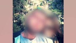 Άργος: Στον εισαγγελέα ο άνδρας που χτύπησε με σίδερο και περιέλουσε με χλωρίνη τη σύζυγό του