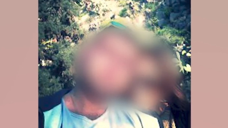 Άργος: Στον εισαγγελέα ο άνδρας που χτύπησε με σίδερο και περιέλουσε με χλωρίνη τη σύζυγό του