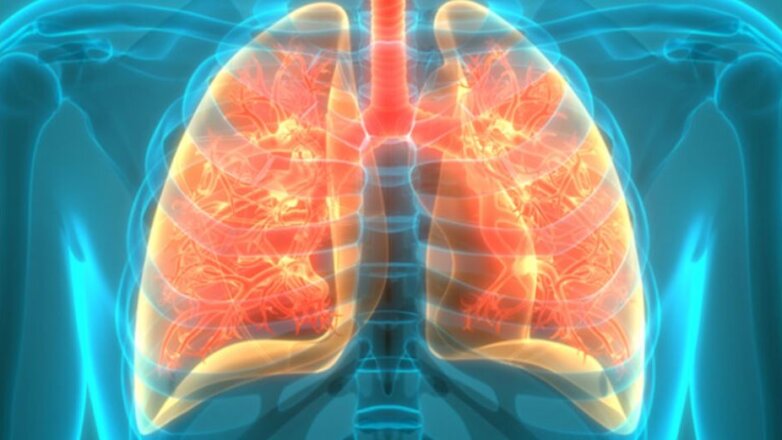 Κυστική ίνωση: Σημαντική βελτίωση στη ζωή των ασθενών από τη λήψη νέων τροποποιητών