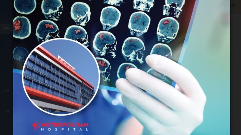 Τεχνητή νοημοσύνη για αντιμετώπιση εγκεφαλικών επεισοδίων στο Metropolitan Hospital