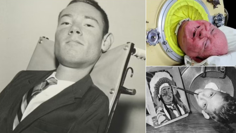 Πέθανε ο Paul Alexander, που έζησε 70 χρόνια μέσα σε έναν σιδερένιο πνεύμονα