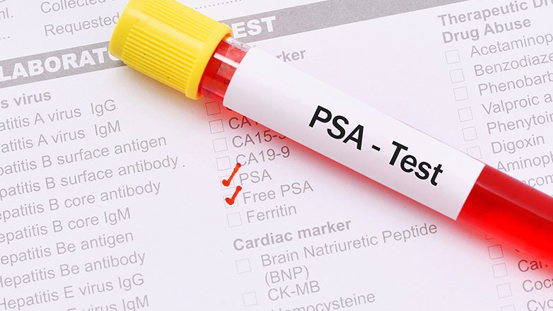 Ειδικό Προστατικό Αντιγόνο (PSA): Σημασία και εξετάσεις