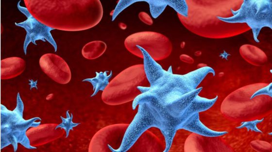 Ο FDA εγκρίνει για πρώτη φορά θεραπεία για ασθενείς με ασυμπτωματικό πολλαπλούν μυέλωμα υψηλού κινδύνου