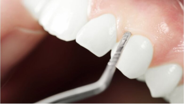 Τα νοσήματα του στόματος επιβαρύνουν πάνω από 3,5 δισ. ανθρώπους