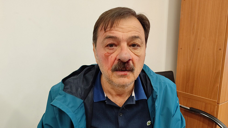 Συνεργάτης του Αχ. Μπέου ξυλοκόπησε δημοτικό σύμβουλο της Λαϊκής Συσπείρωσης