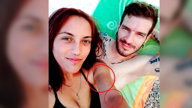 Τα ψεύτικα χαμόγελα και οι μώλωπες της Κυριακής