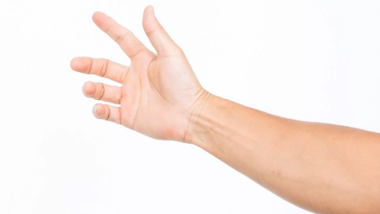 Νόσος Dupuytren: Οριστική αντιμετώπιση 