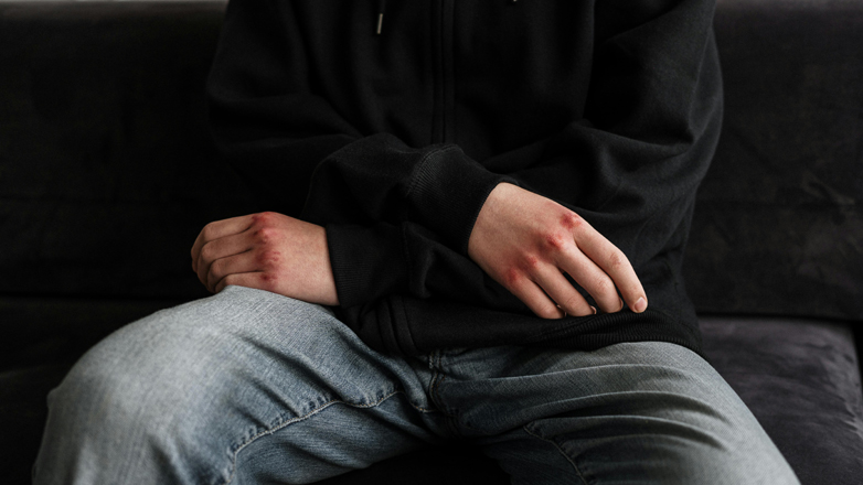 Πάτρα: Θύμα οπαδικής βίας 17χρονος