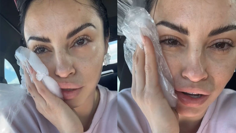 Ατύχημα για τη Δήμητρα Αλεξανδράκη – Τι συνέβη