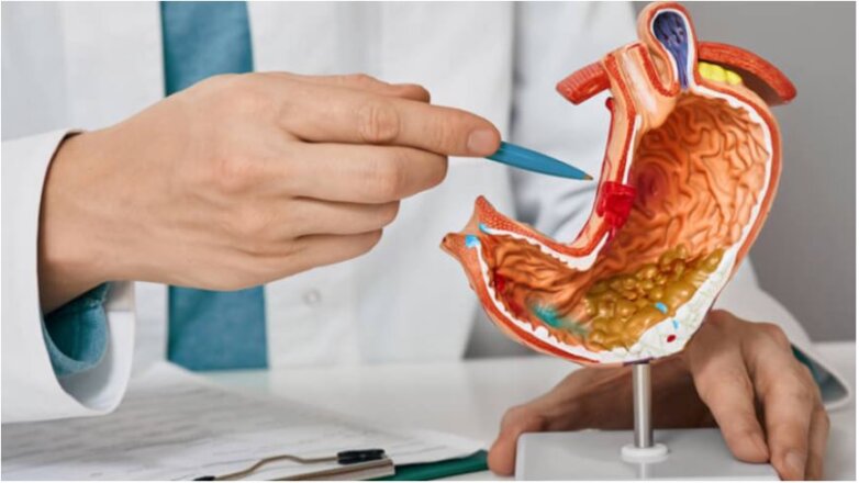 Καούρες: Γαστρο-οισοφαγική παλινδρόμηση ή διαφραγματοκήλη;