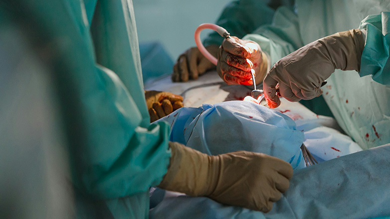 Mεταμοσχεύσεις ήπατος σε παιδιά στην Ελλάδα θα αρχίζουν από το 2026 Mεταμοσχεύσεις ήπατος σε παιδιά στην Ελλάδα θα αρχίζουν από το 2026