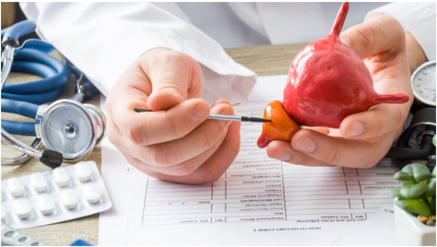 Καρκίνος του προστάτη: Τι πρέπει να γνωρίζουν όλοι οι άνδρες για τη νόσο