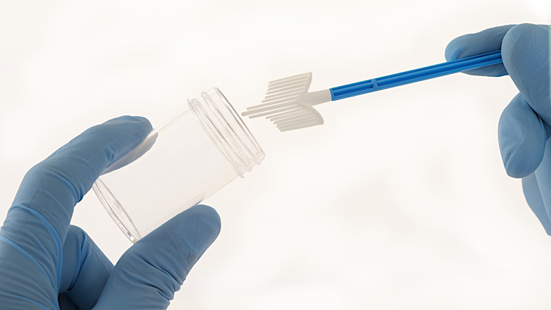 Τα αποτελέσματα του ΠΑΠ τεστ μου ήταν μη φυσιολογικά – Και τώρα τι;