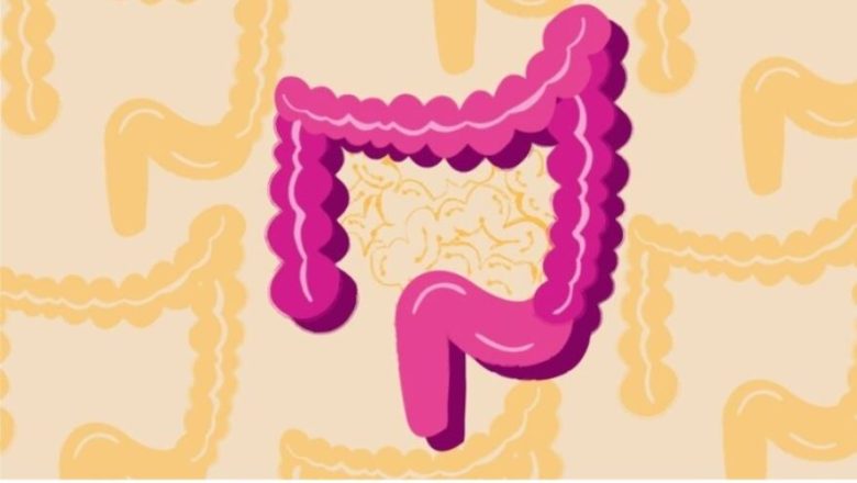 Ανησυχητική αύξηση του καρκίνου του παχέος εντέρου σε νέα άτομα