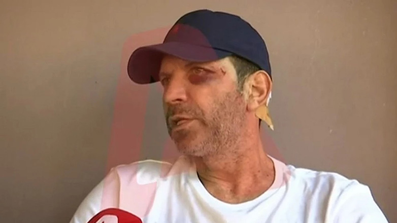 Έδειραν εστιάτορα στο Αγρίνιο με γκλοπ