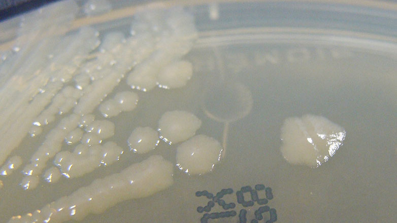 ΕΟΔΥ: Ανιχνεύτηκε δείγμα σαλμονέλας στο δίκτυο υδροδότησης της Μαγνησίας