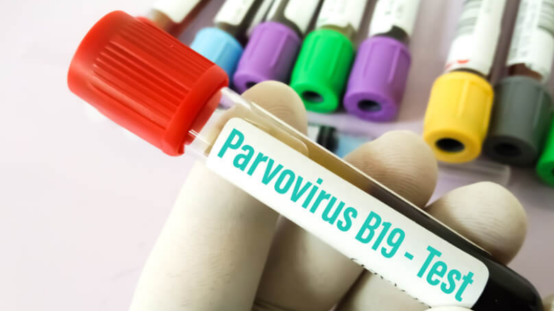 Παρβοϊός: Συμπτώματα, διάγνωση και αντιμετώπιση