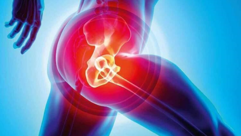 Αρθροπλαστική ισχίου, η σύγχρονη λύση για την επώδυνη αρθρίτιδα