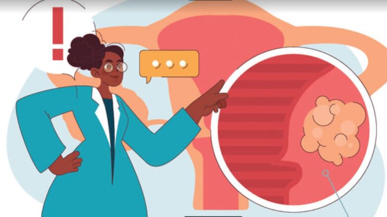 Ινομυώματα: Συμπτώματα, διάγνωση και αντιμετώπιση με εμβολισμό