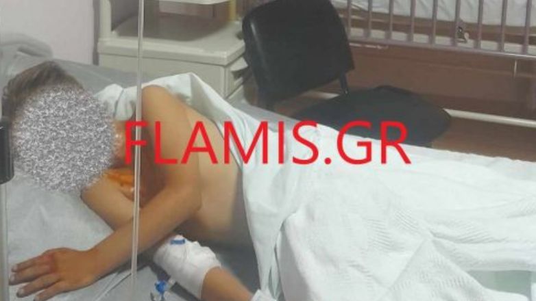Πάτρα: Στο νοσοκομείο 9χρονος με σοβαρά εγκαύματα από βεγγαλικό